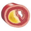 Self-Care Cholesterol