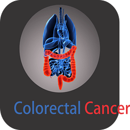 Colorectal Cancer