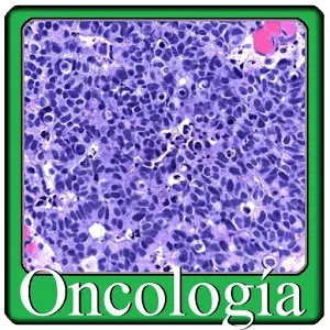 Oncología preguntas de examen