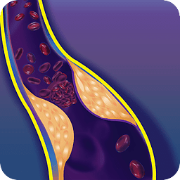 Intl. VTE &amp; Cancer Guide...