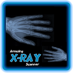 惊人的X射线扫描仪