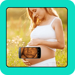 BABY SCANNER 4D ULTRASOUND