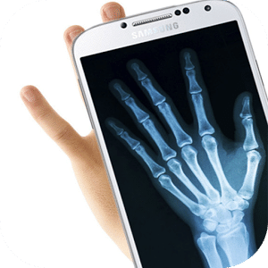 X-Ray Scanner for free