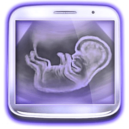 胎儿超声波扫描 Baby Pregnancy Ultrasound